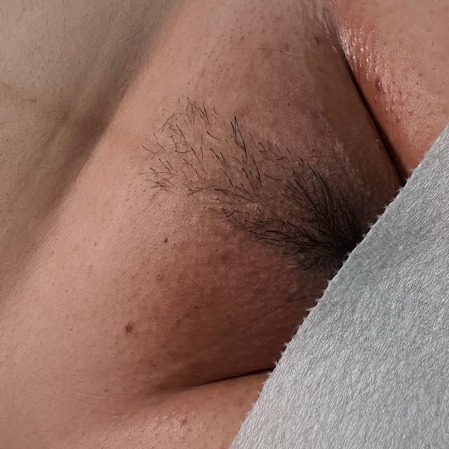 1 year of Brazilian waxes 